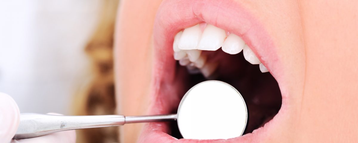 Caries,  ¿genética o hábitos higiénicos?