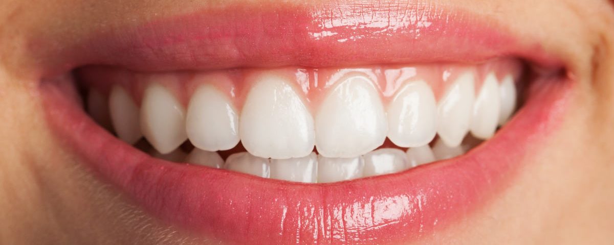 ¿Qué les pasa a los huesos cuando perdemos dientes?